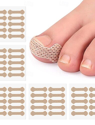  5 db benőtt köröm korrektor matrica paronychia kezelés pedikűr lábköröm ápolás korrektor tapasz korrekciós matricák