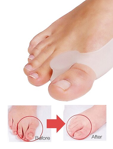 زوج واحد من فاصل أصابع القدم المصنوع من السيليكون لتصحيح أروح القدم ، جهاز ضبط أصابع القدم ، جهاز خارجي للعناية بالقدم ، أداة فاصل للأصابع الكبيرة ، يعمل على تخفيف آلام القدم